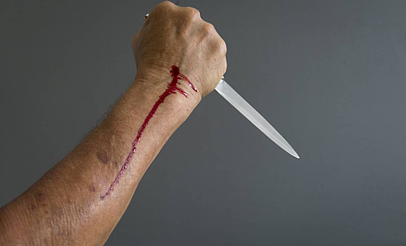 Украинская педагог решила атаковать своего сослуживца ножом, руководствуясь ревностью