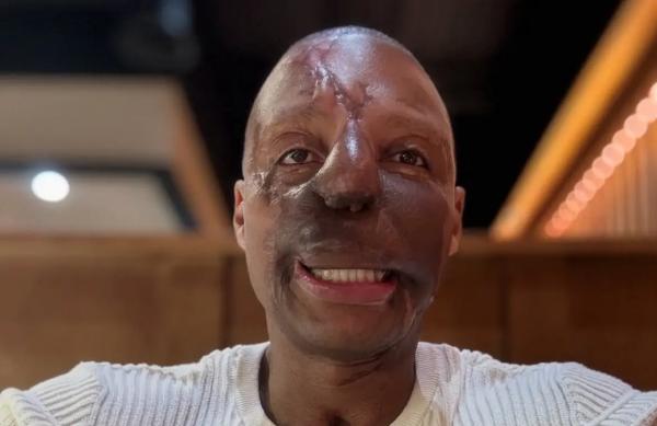 Что случилось с Рэнди Адамсом? Сообщается, что Rise up Ran подвергся жестокому нападению