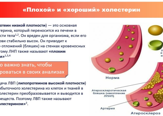 Выявлена еда, способствующая уменьшению количества «плохого» холестерина