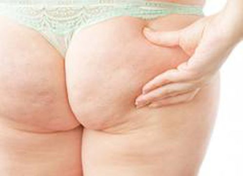 Как сделать попу упругой и красивой? Как сделать попу упругой и красивой?